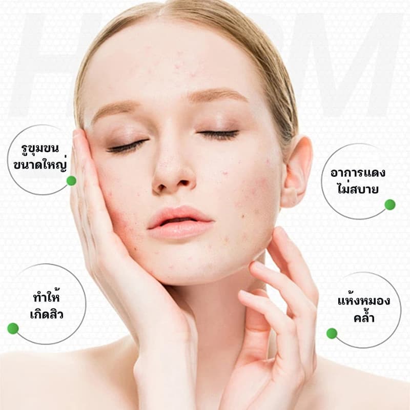 YTL🌵เจลว่านหางจระเข้ Aloe Vera 99% 300ml ชุ่มชื้น ซูทติ้ง เนื้อเจลเข้มข้น ซึมซาบไว ไม่เหนียวเหนอะหนะ - 2