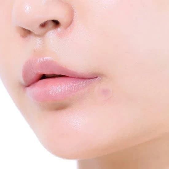 แผ่นแปะสิว แผ่นดูดสิว Olive Young Care Plus Spot Patch - 5