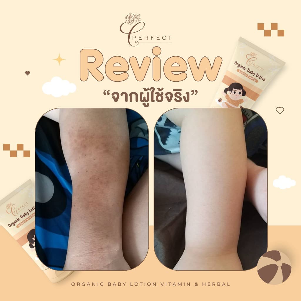 PERFECT โลชั่นเด็กออร์แกนิค บำรุงผิวขาวกระจ่างใส แก้ขาลาย ลดรอยยุงกัด กู้ผิวคล้ำเสีย - 5