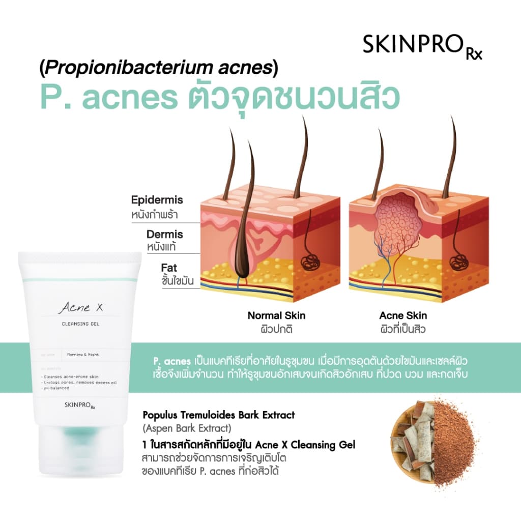 ขายดีอันดับ 1 SKINPRO Rx Acne X Cleansing Gel 50ml คลิ่นซิ่งเจลสูตรสำหรับผิวมัน/เป็นสิว ลดการเกิดสิว - 4