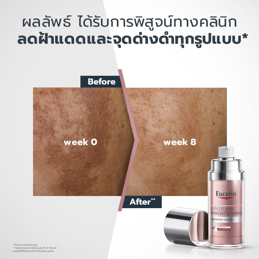Eucerin SPOTLESS BRIGHTENING THIAMIDOL BOOSTER SERUM 30 ML เซรั่มจัดการฝ้าแดด กระ จุดด่างดำแก้ยาก - 3