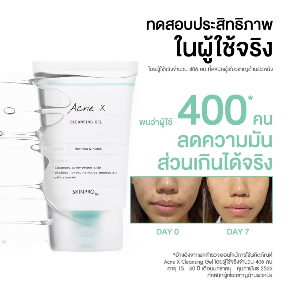ขายดีอันดับ 1 SKINPRO Rx Acne X Cleansing Gel 50ml คลิ่นซิ่งเจลสูตรสำหรับผิวมัน/เป็นสิว ลดการเกิดสิว - 1